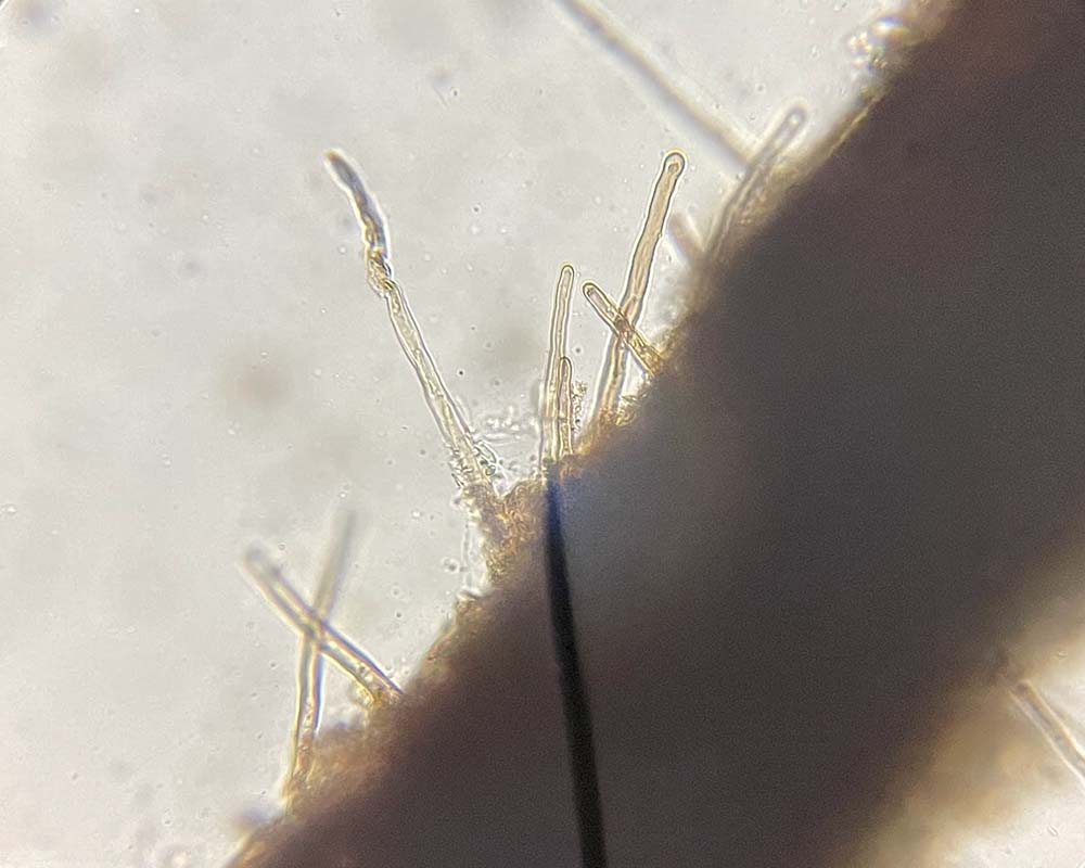 Root hairs forming a relationship with beneficial fungi